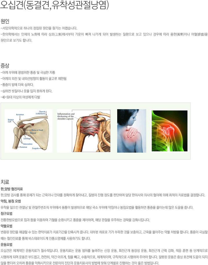 오십견