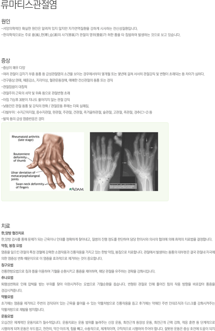 류마티스
