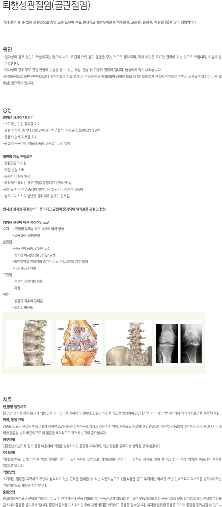 퇴행성관절염