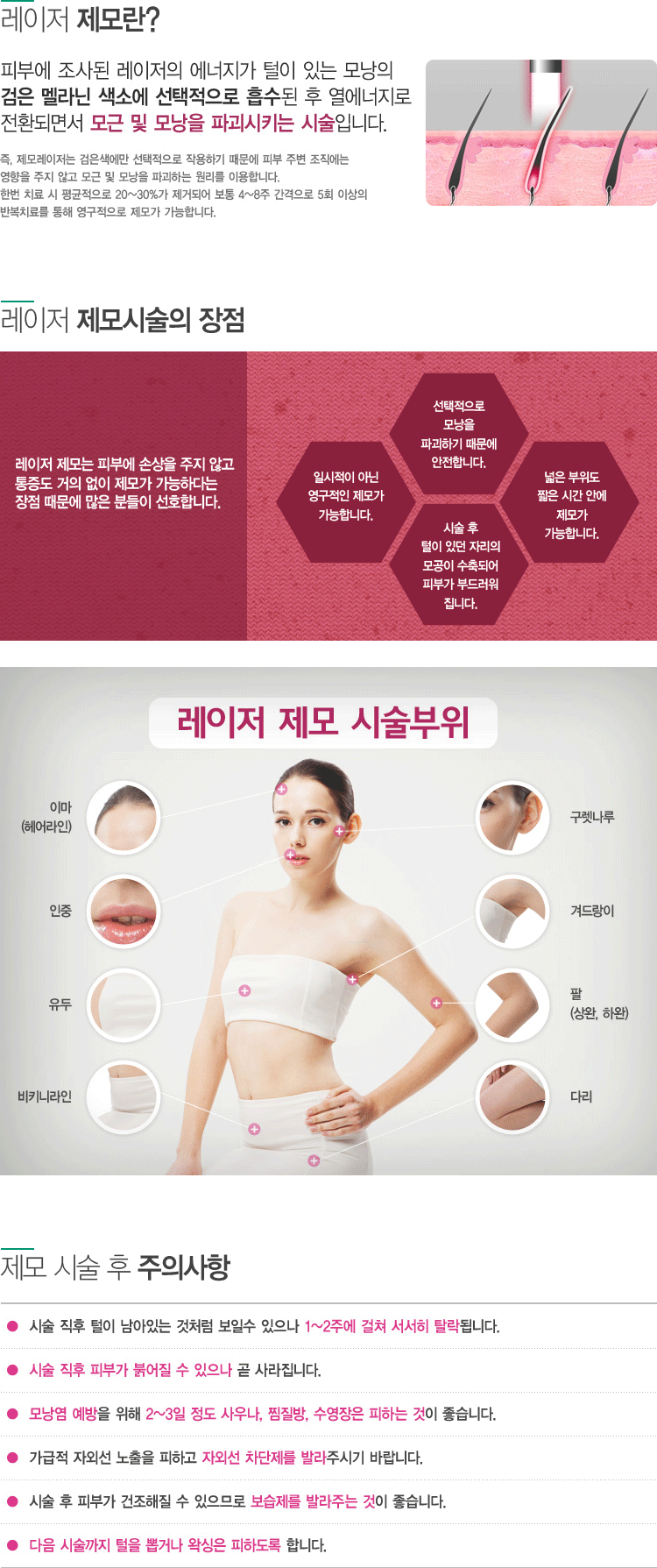 제모